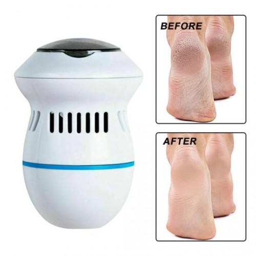 Professional dual-speed USB rechargeable electronic callus remover, perfect for effective foot care