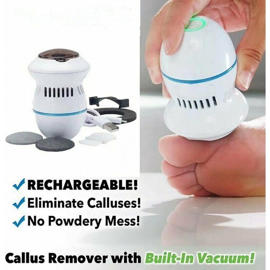 Professional dual-speed USB rechargeable electronic callus remover, perfect for effective foot care