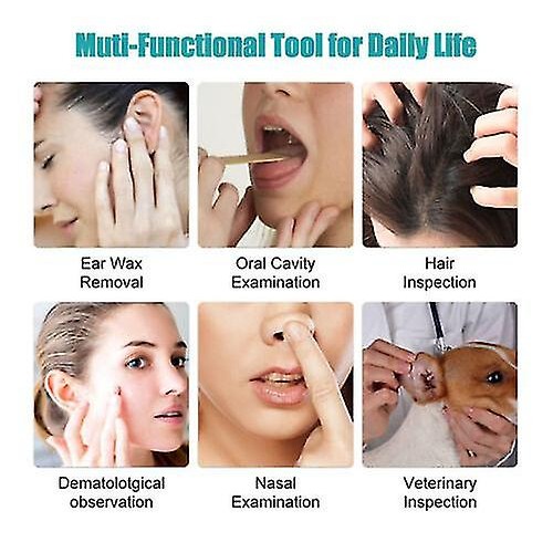 NE3pro Otoscope: High-Resolution 1080P HD Video, Elimination Spoon, and Advanced Load Otoscope