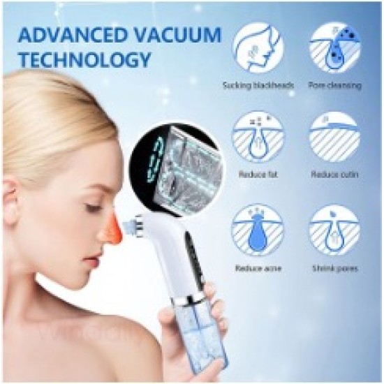 USB Rechargeable Blackhead Remover Vacuum Pore Cleaner - Effortless Pore Cleansing and Skin Rejuvenation