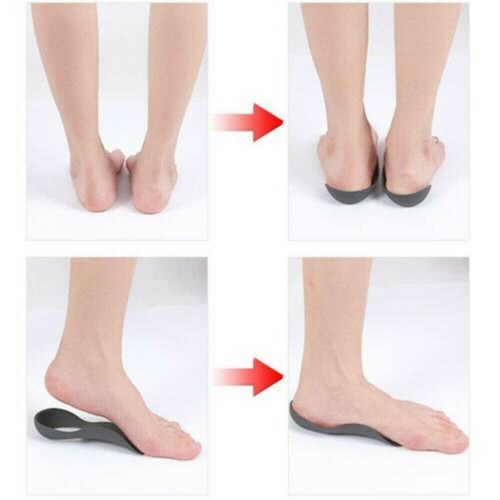 Flat foot corrective insoles with arch support, designed for foot comfort and posture improvement