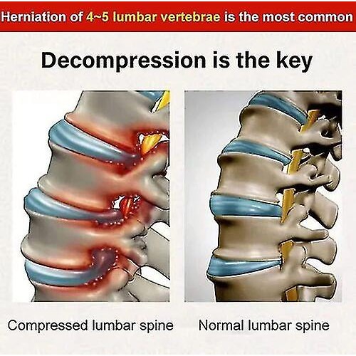 Anti-Pain Knee Joint Spray: Relieve Stiffness, Improve Mobility |image