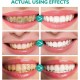 Baking Soda Teeth Whitening Mousse Naturally Brighten Your Smile |image
