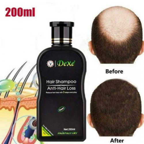 Dexe Herbal Anti Hair Loss Shampoo Unisex, 200ml |image