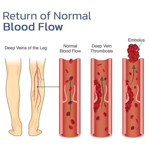 Extended Acupressure Sports Knee Pads: Self-Heating Shaping Knee Sleeve |image