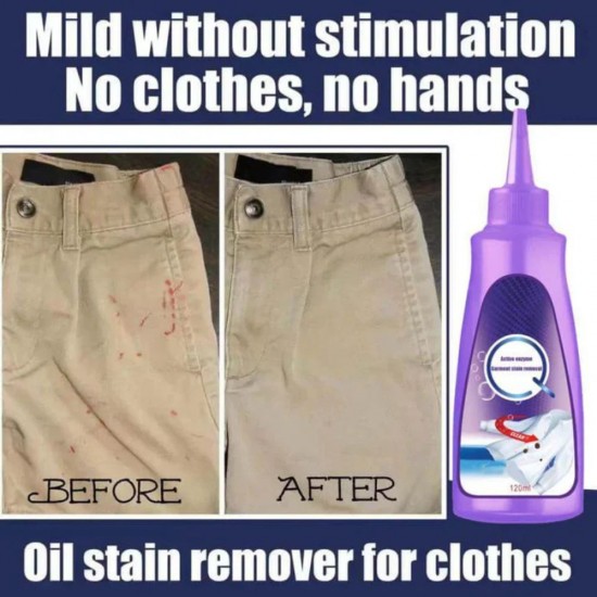 Active Enzyme Laundry Stain Remover 120ml Stubborn Stains Cleaner |image
